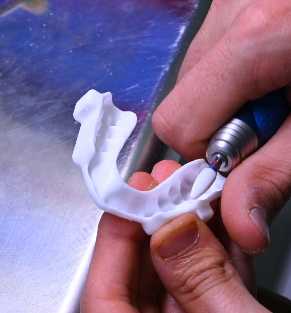 Oral-Appliance_image-2